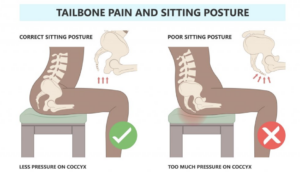 A diagram showing the correct positioning of the hips and pelvic floor for optimal weight distribution to reduce back pain and tension.
